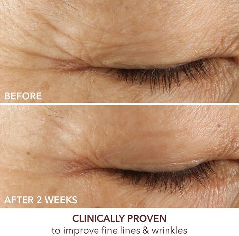 دكتور دينيس جروس ريتينول المتقدم + مصل تصحيح العين الثلاثي الفيروليك: بشرة مشدودة، تعزز الترطيب، تقلل مظهر التجاعيد والتجاعيد، 0.5 أونصة in Kuwait