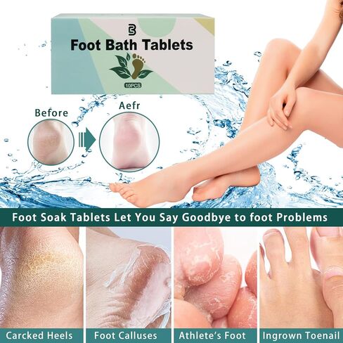 اقراص نقع القدم من جينجبيل، 10 قطع طبيعية، نقع القدم، لتحسين النوم والتدليك والاسترخاء in Kuwait