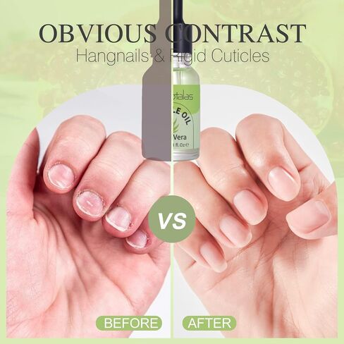 Cuticle Oil for Nails, Jojoba Nail Cuticle Oil for Manicure Contain Vitamin B & E, Solar Hydrating Oil Strengthens Nail Conditioner, Natural Cuticle Oil Prevents Hangnails & Chapped-Cherry in Saudi Arabia