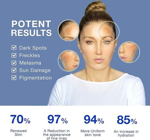 Admirada Dark Spot Remover For Face, Dark Spot Corrector, Hyperpigmentation Treatment, Melasma Treatment For Face, Dark Spot Corrector For Face And Body With Safe Ingredient For All Skin Types in Kuwait