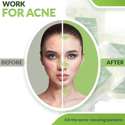 بودرة قسيل من هدى اورجانيكس، 20 غرام - سر الجمال الصومالي المضاد للصومال، قناع تنظيف عميق طبيعي متعدد الاغراض للوجه والشعر والجسم. ينظف ويساعد في علاج حب الشباب ويوفر بشرة نقية in Kuwait