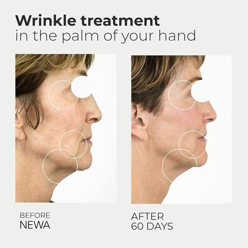 NEWA Classic Starter Kit Skin Care System Anti-Aging Facial Treatment Skin Tightening Technology for Home Use. Boost Oxygen, Increase Collage, Reduces Wrinkles (Include 2 Gel Packs) in Saudi Arabia