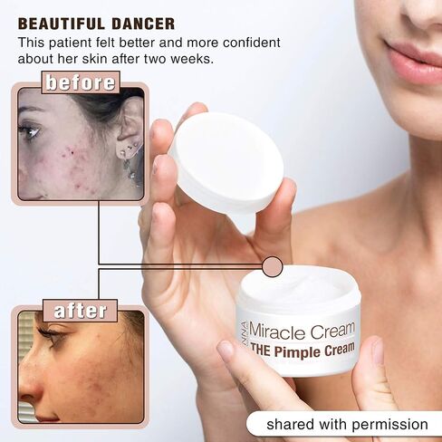 Anna Guanche MD Miracle Cream - Acne Treatment that Quickly Reduces Pimples & Redness in Saudi Arabia