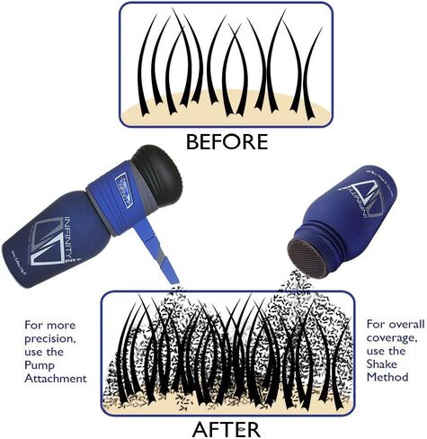 Infinity Hair Fiber - Hair Loss Concealer - Hair Thickening Fiber for Men & Women - Dark Brown, 15g in Saudi Arabia