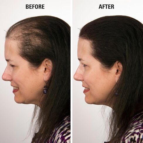 Infinity Hair Fiber - Hair Loss Concealer - Hair Thickening Fiber for Men & Women - Dark Brown, 15g in Saudi Arabia