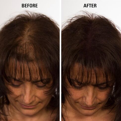 Infinity Hair Fiber - Hair Loss Concealer - Hair Thickening Fiber for Men & Women - Dark Brown, 15g in Saudi Arabia