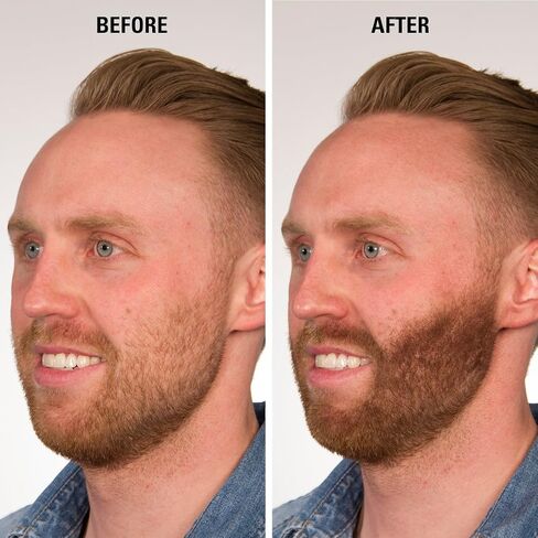 Infinity Hair Fiber - Hair Loss Concealer - Hair Thickening Fiber for Men & Women - Dark Brown, 15g in Saudi Arabia