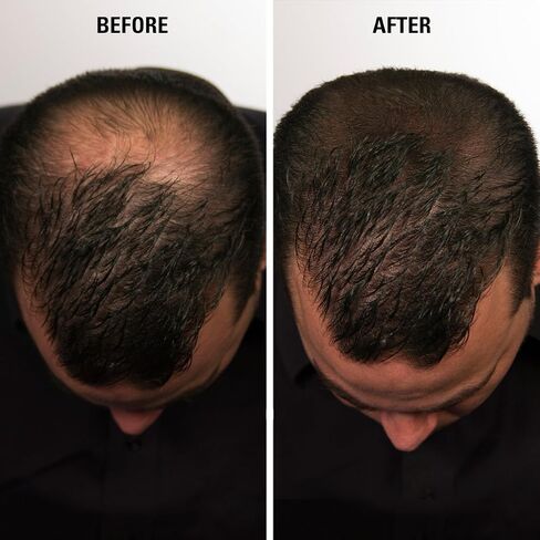 Infinity Hair Fiber - Hair Loss Concealer - Hair Thickening Fiber for Men & Women - Dark Brown, 15g in Saudi Arabia