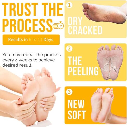 زيت تقشير أصفر، زيت تقشير أصفر قوي للغاية لتفتيح البشرة، مناسب للبشرة الداكنة والجسم والوجه والبقع الداكنة وتفتيح البشرة - 30 مل in Kuwait