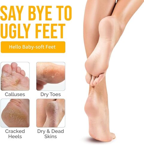 زيت تقشير أصفر، زيت تقشير أصفر قوي للغاية لتفتيح البشرة، مناسب للبشرة الداكنة والجسم والوجه والبقع الداكنة وتفتيح البشرة - 30 مل in Kuwait