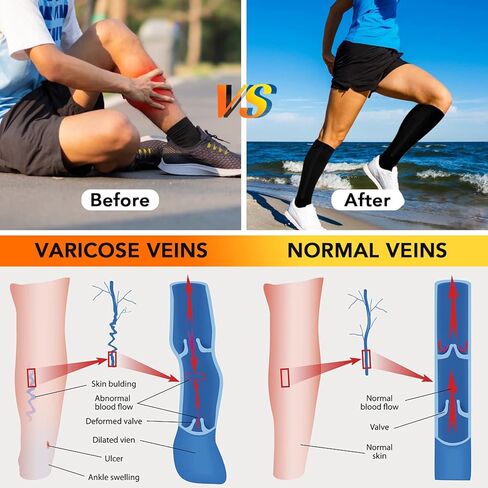 3 Pairs Zipper Copper Compression Socks for Women Men, Open Toe Medical Compression Knee High Stockings for Circulation Support in Kuwait