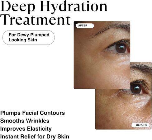 MATKAS Korean Triple Pure Hyaluronic Acid Serum for Face + 2% Niacinamide B3 + Vitamin B5 + 8 Peptides for Deep Firming, Plump Wrinkles, Hydrating Dewy Skin, Anti Aging Acido Hialuronico Facial Serum in Saudi Arabia