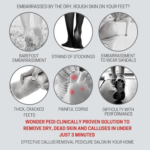 Callus Remover - Instant Exfoliating Peel Foot Spray - Feet Dead Skin Remover Cracked Heels Softener – Home Spa Pedicure Treatment - Works With any Foot File or Scrubber. Wonder Pedi in Kuwait