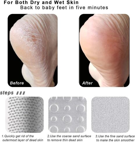 15 in 1 Pedicure Kit, Professional Foot File Kit Pedicure Tools for Feet,Pedicure Foot Spa Products Callus Dead Skin Remover Set for Men Women Foot Care Salon in Saudi Arabia