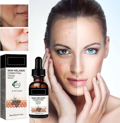 3 قطع من مصل تصحيح الميلانين للوجه، مصل تصحيح الميلانين للوجه، مصل التوهج لتصحيح البقع الداكنة، مصل الوجه اليومي مصحح البقع الداكنة، مصل تصحيح الميلانين للوجه in Kuwait