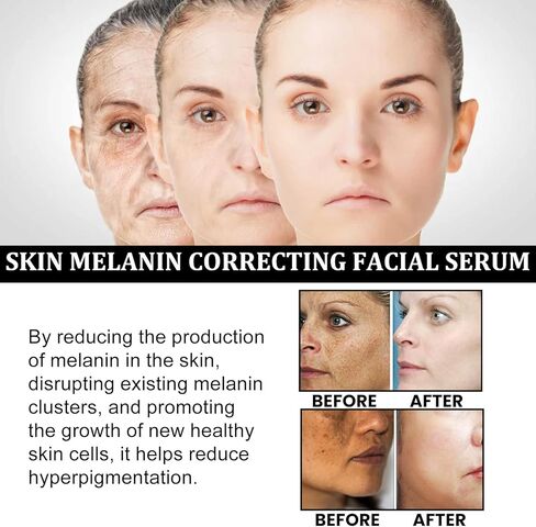 3 قطع من مصل تصحيح الميلانين للوجه، مصل تصحيح الميلانين للوجه، مصل التوهج لتصحيح البقع الداكنة، مصل الوجه اليومي مصحح البقع الداكنة، مصل تصحيح الميلانين للوجه in Kuwait