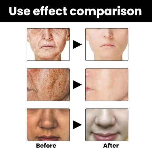 3 قطع من مصل تصحيح الميلانين للوجه، مصل تصحيح الميلانين للوجه، مصل التوهج لتصحيح البقع الداكنة، مصل الوجه اليومي مصحح البقع الداكنة، مصل تصحيح الميلانين للوجه in Kuwait