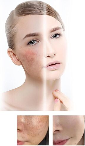 3 قطع من مصل تصحيح الميلانين للوجه، مصل تصحيح الميلانين للوجه، مصل التوهج لتصحيح البقع الداكنة، مصل الوجه اليومي مصحح البقع الداكنة، مصل تصحيح الميلانين للوجه in Kuwait