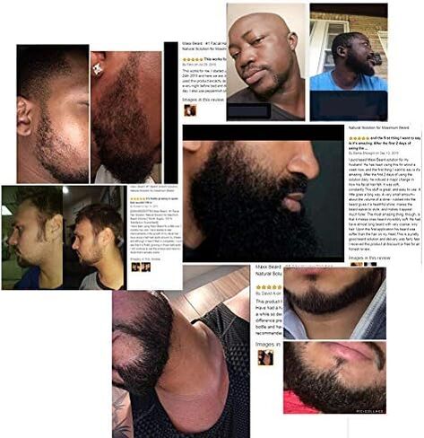 Maxx Beard -#1 Beard Growth Solution, Natural Solution for Maximum Beard Volume-2 Month Supply in Saudi Arabia