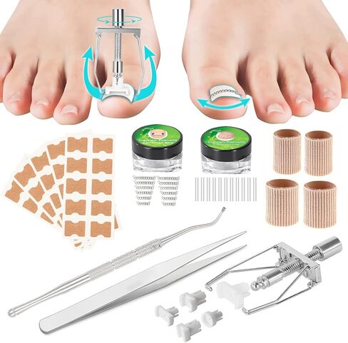 Ingrown Toenail Treatment, Professional Ingrown Toenail Removal Kit with File and Lifter, 50Pcs Toenail Corrector Patch and Toe Protectors for Toenail Correction Pain Relief in Kuwait