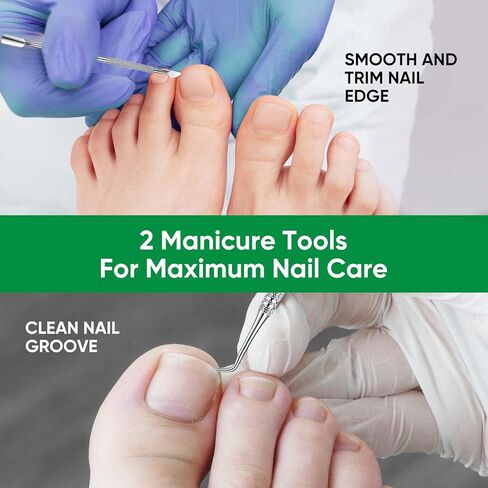 Ingrown Toenail Treatment, Professional Ingrown Toenail Removal Kit with File and Lifter, 50Pcs Toenail Corrector Patch and Toe Protectors for Toenail Correction Pain Relief in Kuwait