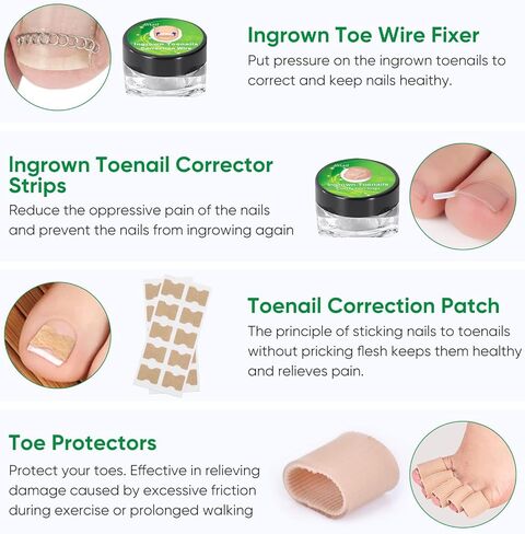 Ingrown Toenail Treatment, Professional Ingrown Toenail Removal Kit with File and Lifter, 50Pcs Toenail Corrector Patch and Toe Protectors for Toenail Correction Pain Relief in Kuwait