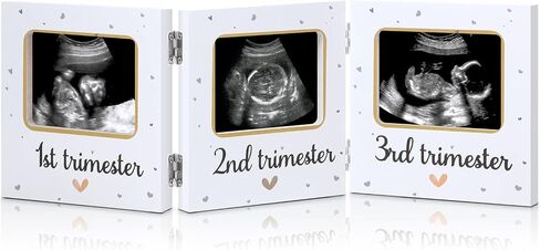 Amyhill Triple Ultrasound Picture Frames, Baby Sonogram Photo Frame Pregnancy Ultrasound Keepsake Frame, Gift for Expecting Parents, Baby Shower Baby Nursery Decor, White in Saudi Arabia