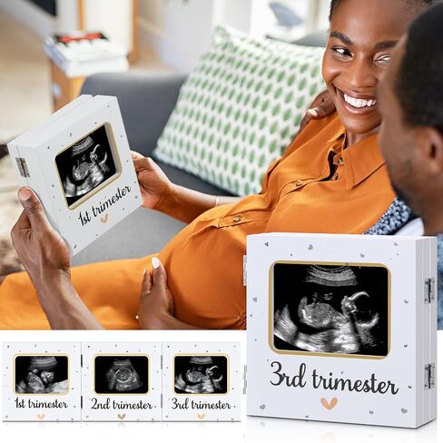 Amyhill Triple Ultrasound Picture Frames, Baby Sonogram Photo Frame Pregnancy Ultrasound Keepsake Frame, Gift for Expecting Parents, Baby Shower Baby Nursery Decor, White in Saudi Arabia