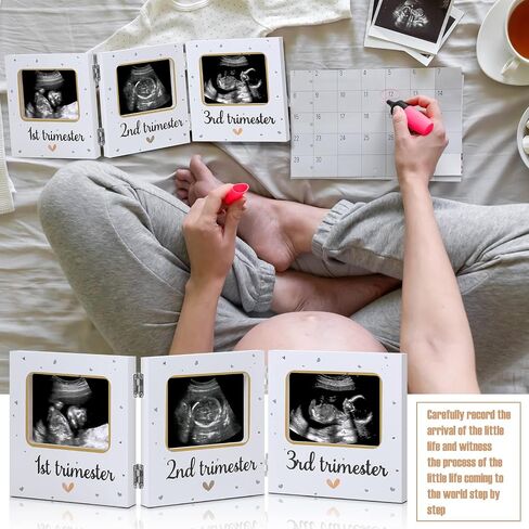 Amyhill Triple Ultrasound Picture Frames, Baby Sonogram Photo Frame Pregnancy Ultrasound Keepsake Frame, Gift for Expecting Parents, Baby Shower Baby Nursery Decor, White in Saudi Arabia
