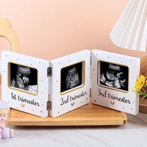 Amyhill Triple Ultrasound Picture Frames, Baby Sonogram Photo Frame Pregnancy Ultrasound Keepsake Frame, Gift for Expecting Parents, Baby Shower Baby Nursery Decor, White in Saudi Arabia