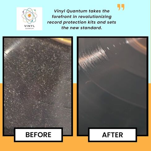 Vinyl Quantum - مجموعة تنظيف أسطوانات الفينيل - كاملة 5 في 1 - تتضمن فرشاة تسجيل مخملية فائقة النعومة، وفرشاة تنظيف صغيرة، وسائل تنظيف مقاس XL، وفرشاة قلم in Saudi Arabia