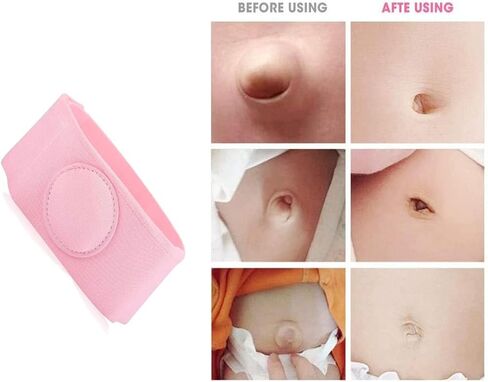 حزام فتق من WenTigDY، حزام فتق بزر بطن الطفل للأطفال، حزام فتق بزر بطن الطفل، حزام فتق علاج علاج الفتق للأطفال الرضع، حزام فتق سري - وردي (قطعتان) in Kuwait