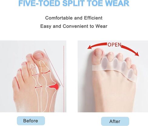 Toe Separators to Correct Bunions - Silicone Toe Spacers for Feet Men and Women, Toe Straighteners for Bunions and Hammertoe, Toe Stretchers for Yoga Practice,3 Packs in Saudi Arabia