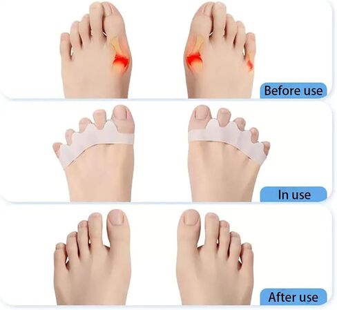 Toe Separators to Correct Bunions - Silicone Toe Spacers for Feet Men and Women, Toe Straighteners for Bunions and Hammertoe, Toe Stretchers for Yoga Practice,3 Packs in Saudi Arabia