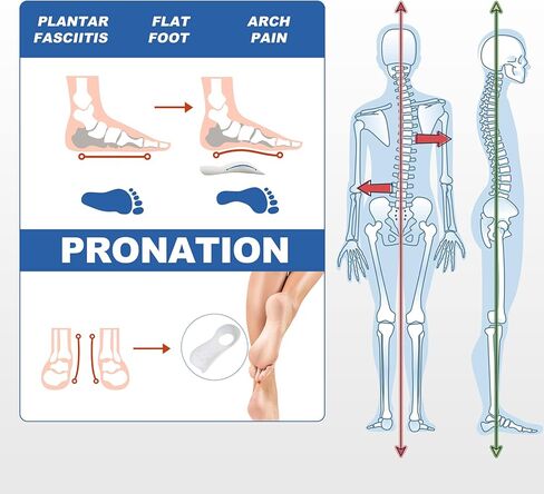 التهاب اللفافة الأخمصية 1.37 بوصة دعامة عالية لتقويم العظام شبه صلبة للقدم المسطحة، وتخفيف آلام القوس، والكب (للرجال 4-6.5 | النساء 5.5-8) in Kuwait