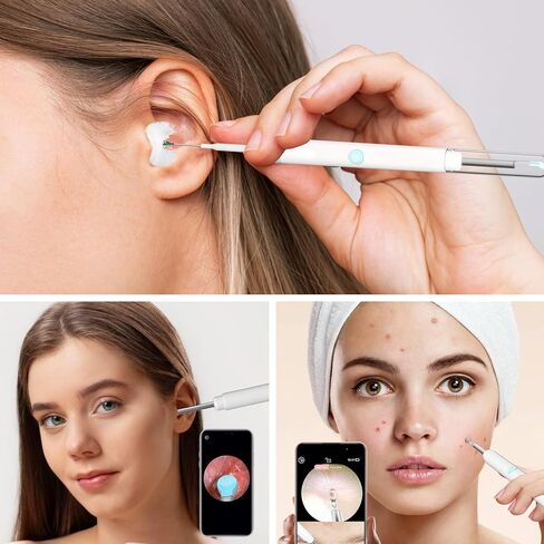 أداة إزالة شمع الأذن من Gickbusus مع كاميرا للأذن وإضاءة، مجموعة تنظيف الأذن الممتازة مع 6 مصابيح LED، أداة تنظيف الأذن بدقة 1080 بكسل in Kuwait