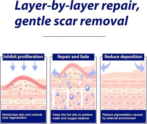 أوراق ندبات السيليكون الطبية لعلاج ندبات الثدي، 4 عبوات من شرائط الهالة الناعمة و4 عبوات من أوراق التثبيت، احتياجات تكبير الثدي بعد الجراحة وتصغير الثدي بعد الجراحة in Kuwait