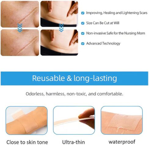 أوراق ندبات السيليكون القابلة لإعادة الاستخدام، شرائط السيليكون الطبية لقطع الحروق الجراحية على القسم C، علاج ندبات الجدرة الضخامية، 6 عبوات 5.9 بوصة × 1.6 بوصة (15 سم × 4 سم) in Kuwait