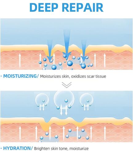 أوراق ندبات السيليكون القابلة لإعادة الاستخدام، شرائط السيليكون الطبية لقطع الحروق الجراحية على القسم C، علاج ندبات الجدرة الضخامية، 6 عبوات 5.9 بوصة × 1.6 بوصة (15 سم × 4 سم) in Kuwait