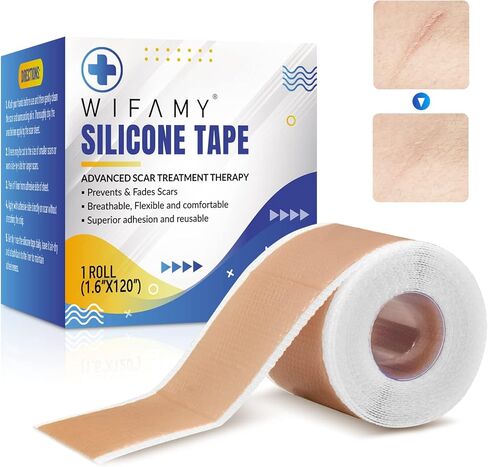 ويفامي اوراق ندبات من السيليكون، شريط سيليكون للندبات مقاس 1.6 انش × 120 انش، شرائط علاج فعالة وقابلة لاعادة الاستخدام لازالة الندوب التي تسببها القسم C وندوب الحروق والجراحة وحب الشباب، 3 متر in Kuwait