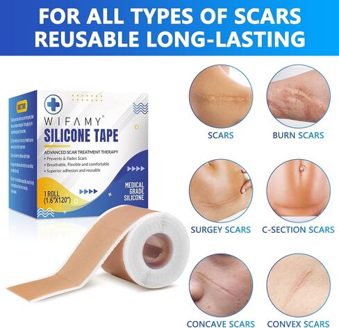 ويفامي اوراق ندبات من السيليكون، شريط سيليكون للندبات مقاس 1.6 انش × 120 انش، شرائط علاج فعالة وقابلة لاعادة الاستخدام لازالة الندوب التي تسببها القسم C وندوب الحروق والجراحة وحب الشباب، 3 متر in Kuwait