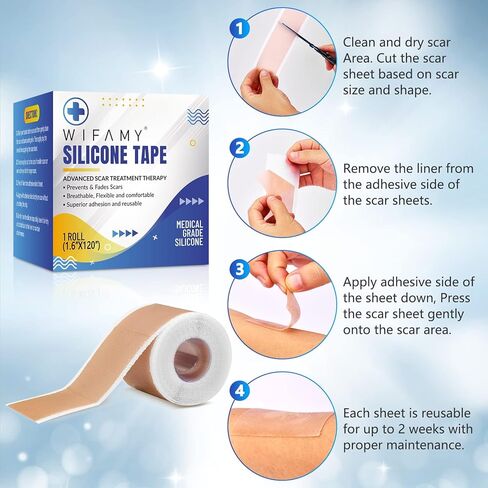 ويفامي اوراق ندبات من السيليكون، شريط سيليكون للندبات مقاس 1.6 انش × 120 انش، شرائط علاج فعالة وقابلة لاعادة الاستخدام لازالة الندوب التي تسببها القسم C وندوب الحروق والجراحة وحب الشباب، 3 متر in Kuwait