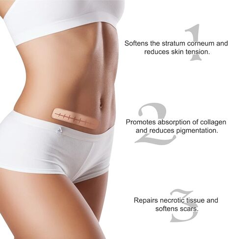 شريط ندبات من السيليكون، شرائط، صفائح (1.6 بوصة × 60 بوصة)، لفافة شريط ندبات من السيليكون - تنعيم وتسطح الندبات الناتجة عن الجراحة، الجدرة، الحروق، حب الشباب، العمليات القيصرية والمزيد، رقعة احترافية لعلاج الندبات in Kuwait