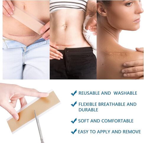 شريط ندبات من السيليكون، شرائط، صفائح (1.6 بوصة × 60 بوصة)، لفافة شريط ندبات من السيليكون - تنعيم وتسطح الندبات الناتجة عن الجراحة، الجدرة، الحروق، حب الشباب، العمليات القيصرية والمزيد، رقعة احترافية لعلاج الندبات in Kuwait