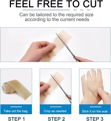 شريط ندبات من السيليكون، شرائط، صفائح (1.6 بوصة × 60 بوصة)، لفافة شريط ندبات من السيليكون - تنعيم وتسطح الندبات الناتجة عن الجراحة، الجدرة، الحروق، حب الشباب، العمليات القيصرية والمزيد، رقعة احترافية لعلاج الندبات in Kuwait