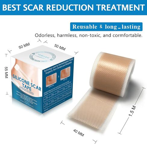 شريط ندبات من السيليكون، شرائط، صفائح (1.6 بوصة × 60 بوصة)، لفافة شريط ندبات من السيليكون - تنعيم وتسطح الندبات الناتجة عن الجراحة، الجدرة، الحروق، حب الشباب، العمليات القيصرية والمزيد، رقعة احترافية لعلاج الندبات in Kuwait
