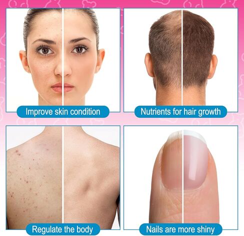 مكمل نمو الشعر البيوتين ONE1X 10,000 ميكروجرام 60 علكة - مكمل قابل للمضغ للبشرة الصحية والشعر والأظافر - فيتامينات الشعر لتساقط الشعر - فيتامينات الشعر الصمغية - نباتي، غير معدّل وراثيًا in Kuwait