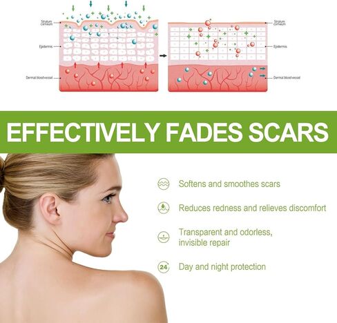 3 قطع من مصل إصلاح الندبات المتقدم من Goopgen، مصل إصلاح الندبات من الدرجة الطبية من Goopgen، إصلاح الندبات، لجميع أنواع الندبات، وخاصة ندبات حب الشباب، وعلامات تمدد دهون البطن والندبات الجراحية (30 مل) in Kuwait