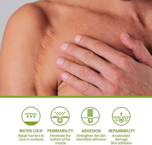 3 قطع من مصل إصلاح الندبات المتقدم من Goopgen، مصل إصلاح الندبات من الدرجة الطبية من Goopgen، إصلاح الندبات، لجميع أنواع الندبات، وخاصة ندبات حب الشباب، وعلامات تمدد دهون البطن والندبات الجراحية (30 مل) in Kuwait