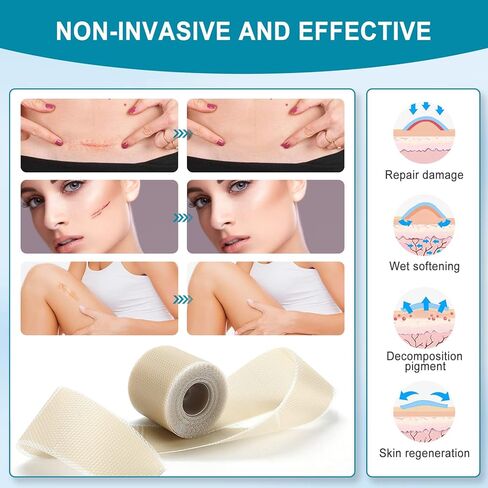 Silicone Scar Sheets - Scar Away Tape Roll (1.6" x 120"Roll) Silicone Strips, Reusable, Professional Scar Removal Sheets for C-Section, Surgery, Burn, Keloid, Acne in Kuwait